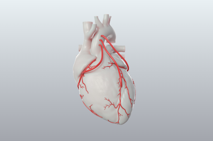 Coronary artery bypass grafting