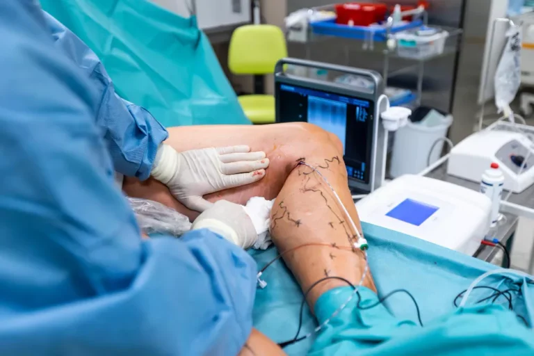 Peripheral Artery Bypass