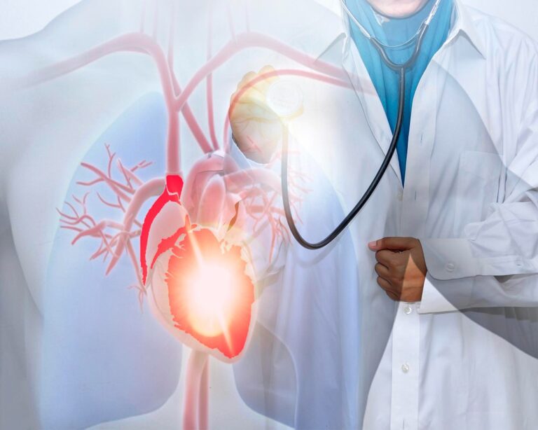 Ventricular Aneurysm