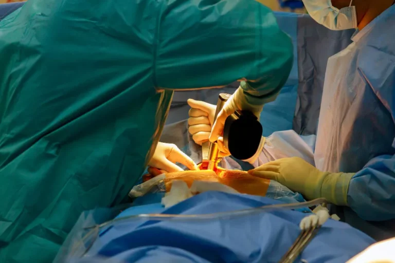 Thoracic Surgery